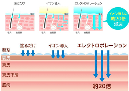 エレクトロポレーション浸透図